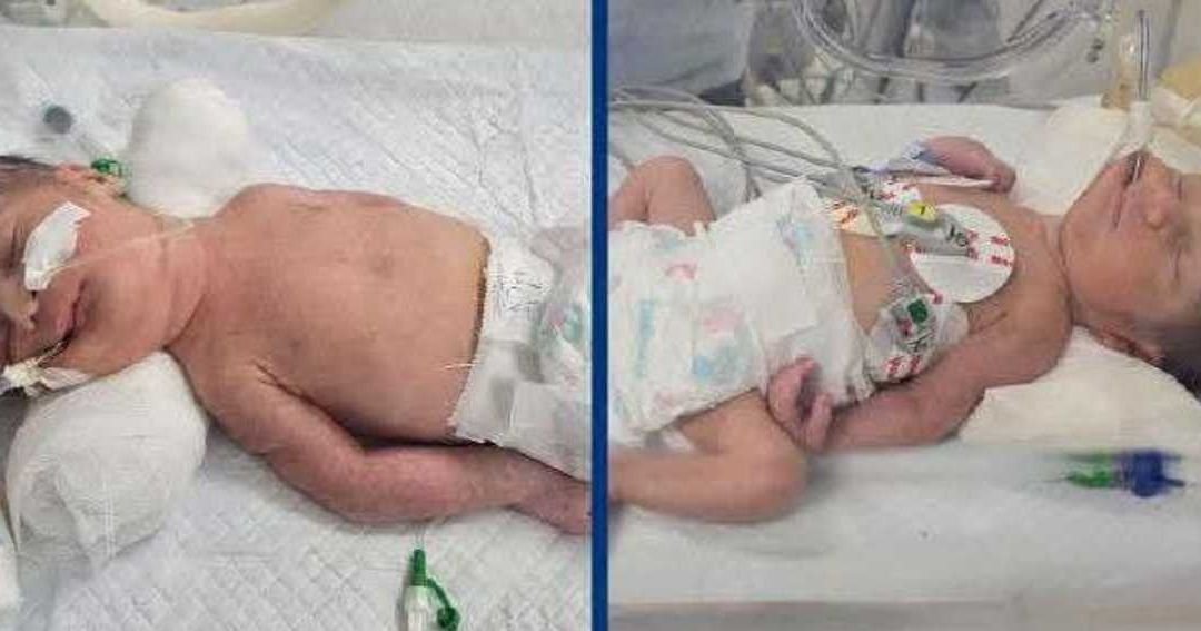 Medical Case in Sohag: Twins Delivered After Mother’s Passing